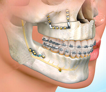 DENTISTA EN LINDAVISTA CROTTE DENTAL