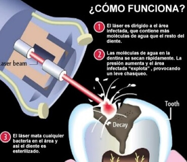 DENTISTA EN LINDAVISTA CROTTE DENTAL