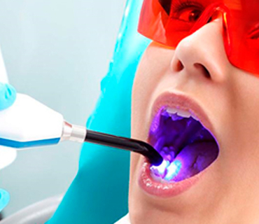 DENTISTA EN LINDAVISTA CROTTE DENTAL